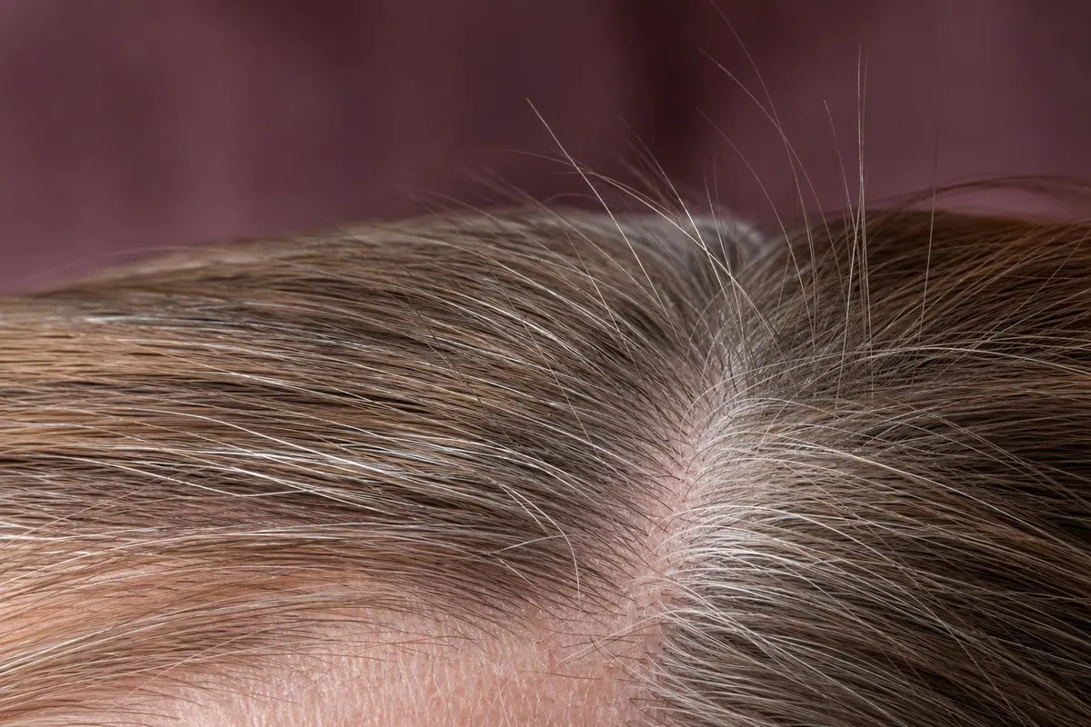 Gros plan macro d’une raie de cheveux fins châtain clair mêlés de cheveux blancs, où le cuir chevelu apparaît nettement entre les mèches